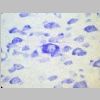 Neuronas Nissl 14.jpg